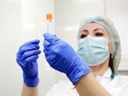 Иркутская область прибавила 85 больных коронавирусом