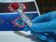 Число зараженных коронавирусом в Иркутской области превысило 40 тысяч