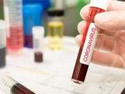 В Иркутской области выявили 72 новых случая заражения коронавирусом