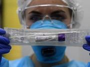 Пятерых жителей Иркутской области обследуют на коронавирус